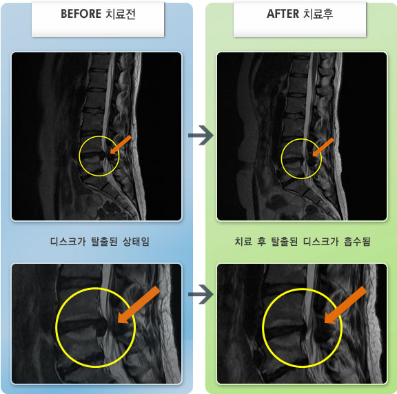 ڻѹ溴 ġ MRI  ġ-ϻȰ   ־.