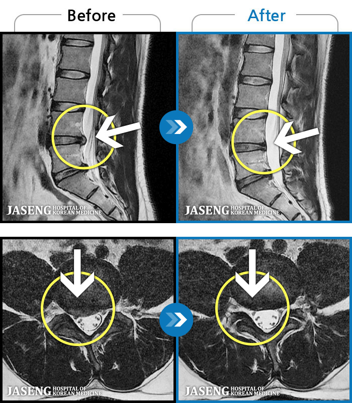 ڻѹ溴 ġ MRI ġ- 㸮 㸮 ̸ ִ.