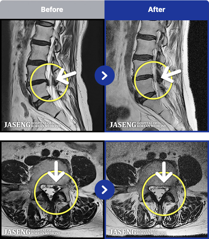 ڻѹ溴 ġ MRI ġ- 㸮, , ߸ ٷϷ ϻȰ Ұ
