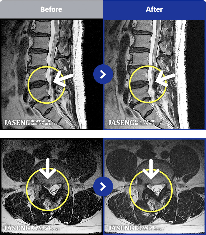 ڻѹ溴 ġ MRI ġ- 㸮 . , ٷϷ ϻ Ȱ Ұ.