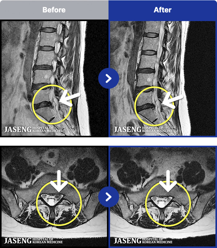 ڻѹ溴 ġ MRI ġ- кο ٸ ٸ ٷϷ Ÿ.
