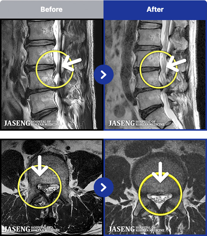 ڻѹ溴 ġ MRI ġ- 㸮