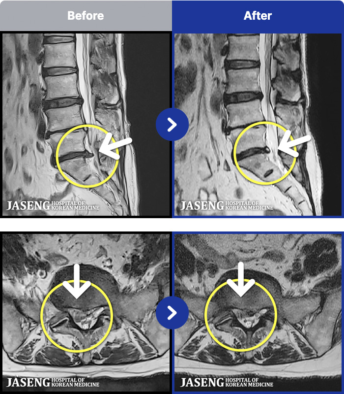 õڻѹ溴 ġ MRI ġ- ߹ٴ ִ · ϼ̽ϴ.