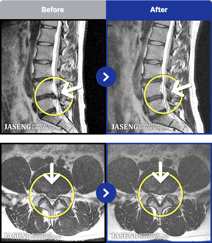 ڻѹ溴 ġ MRI ġ- ߰ Ż 㸮 Բ ٸ ΰ ļ Ұ ·