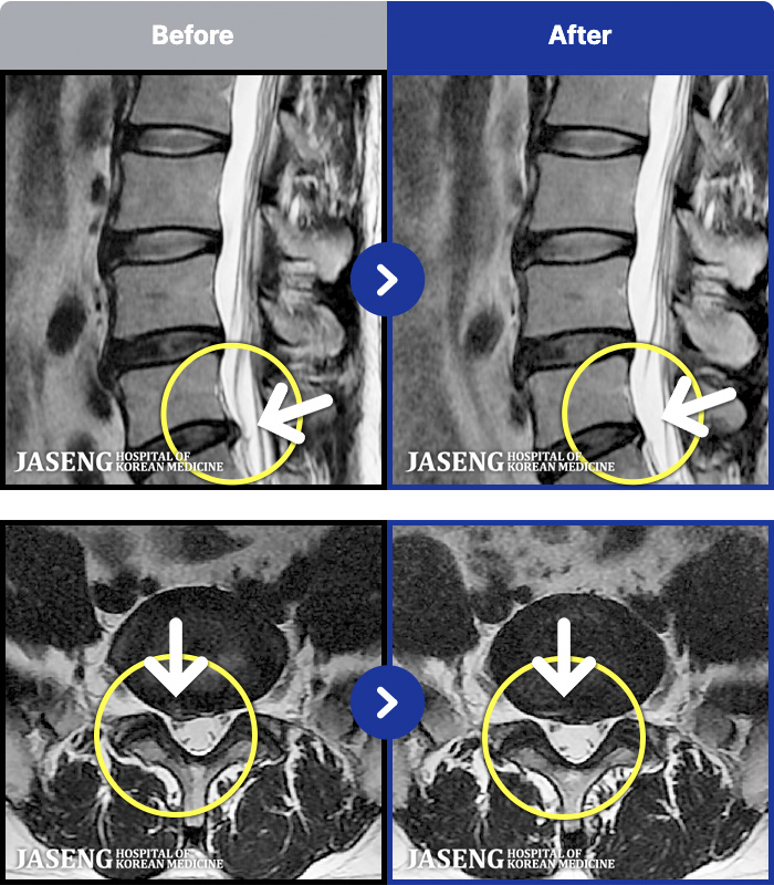 �ڻ��ѹ溴�� ġ���� MRI�� ���� ġ����-������ ��ݺ��� ��������� �������� ���� ����