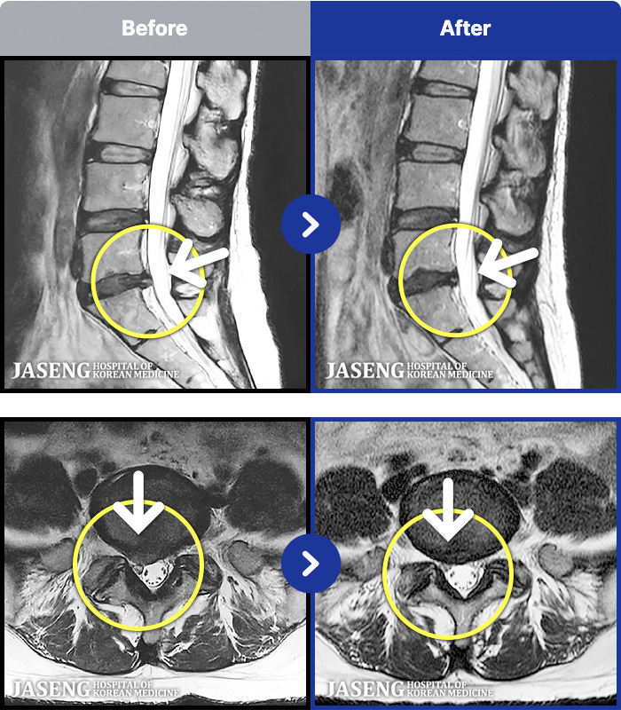 �ڻ��ѹ溴�� ġ���� MRI�� ���� ġ����-���� �� ������ �ٸ��� ���¥�� ������ ��������� �����̸� �ɾ���.