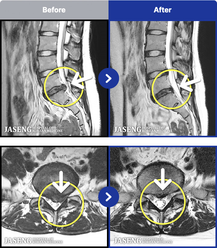 ڻѹ溴 ġ MRI ġ- ϴ.