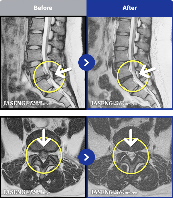 ڻѹ溴 ġ MRI ġ- ȣϿ ũ