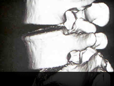 창원자생한방병원 허리질환 퇴행성디스크-정상척추에 관련된 이미지 입니다.