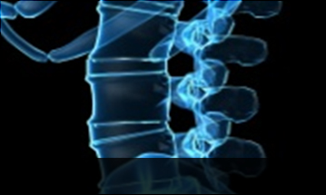 창원자생한방병원 허리질환 척추전방전위증-정상적인 사람의 척추뼈 모습입니다.