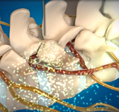 창원자생한방병원 허리치료법 신경근회복술-신경근회복술의 특징 네번째 관련 사진 입니다.